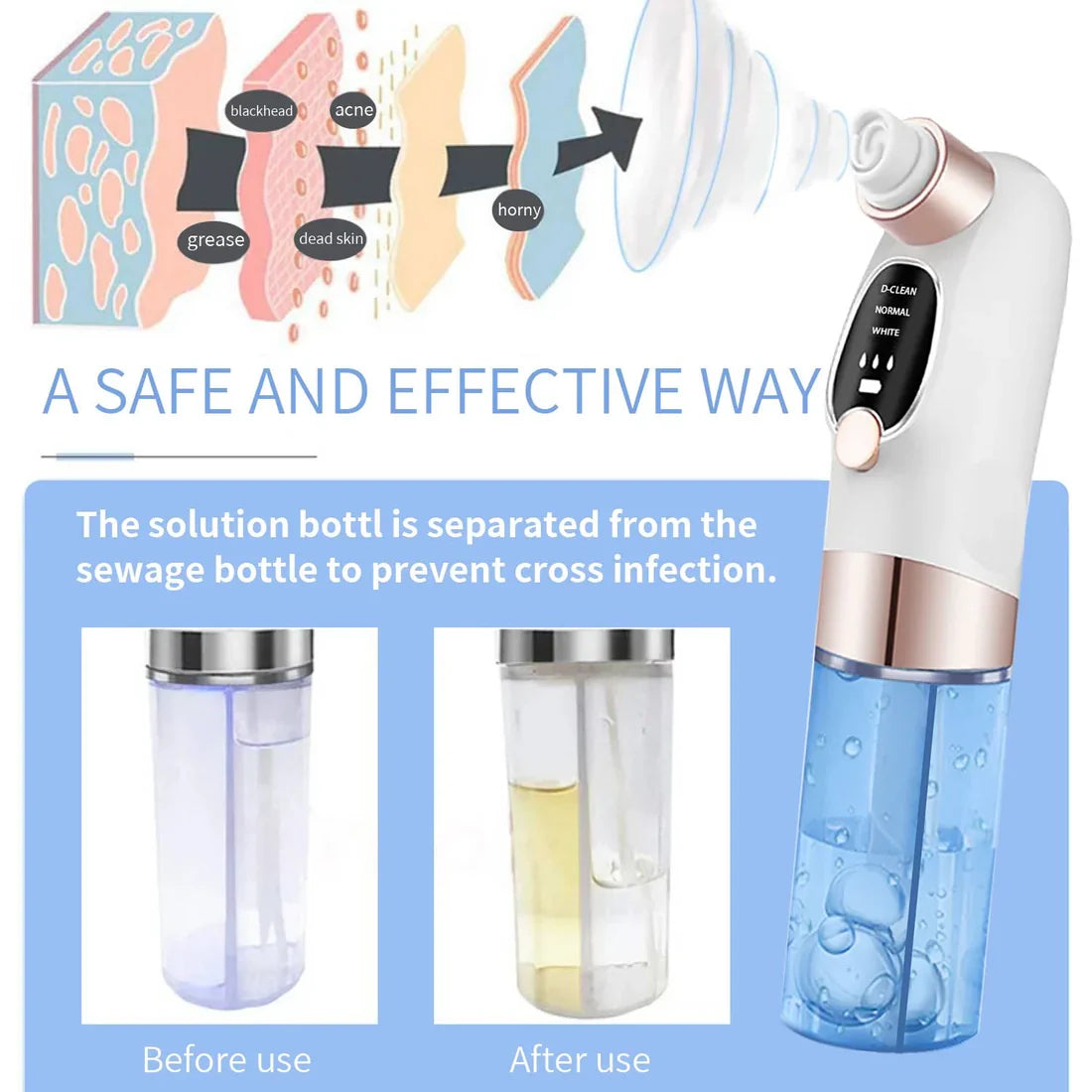 Electric Blackhead Remover Vacuum – Deep Pore Cleaner with LED & 4 Suction Heads for Face & Nose