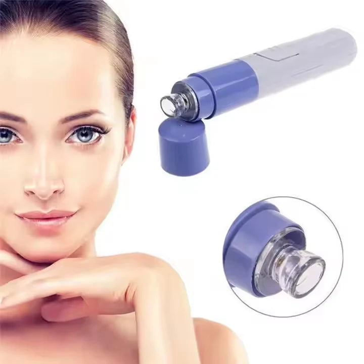 Electric Blackhead Remover Vacuum – Deep Pore Cleaner with LED & 4 Suction Heads for Face & Nose