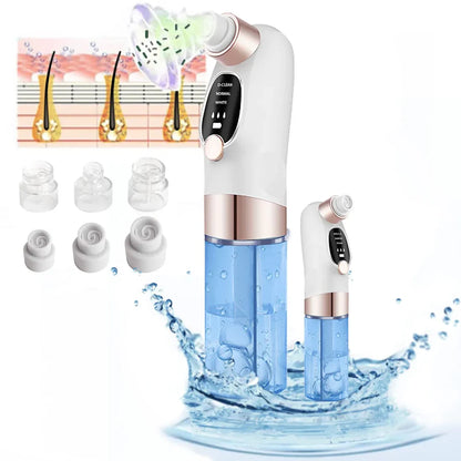 Electric Blackhead Remover Vacuum – Deep Pore Cleaner with LED & 4 Suction Heads for Face & Nose