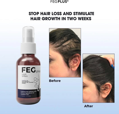 The Most Viral Hair Growth Spray – FEG Plus (USA-Imported Formula)