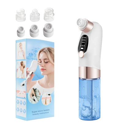 Electric Blackhead Remover Vacuum – Deep Pore Cleaner with LED & 4 Suction Heads for Face & Nose