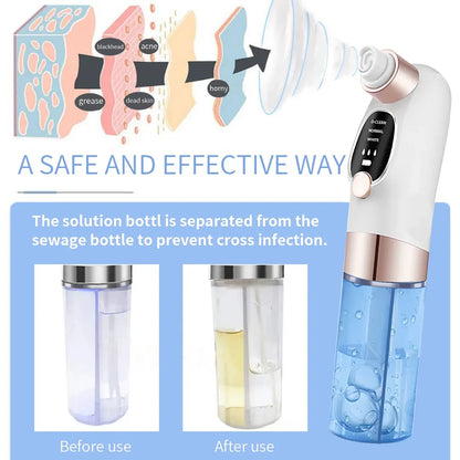 Electric Blackhead Remover Vacuum – Deep Pore Cleaner with LED & 4 Suction Heads for Face & Nose