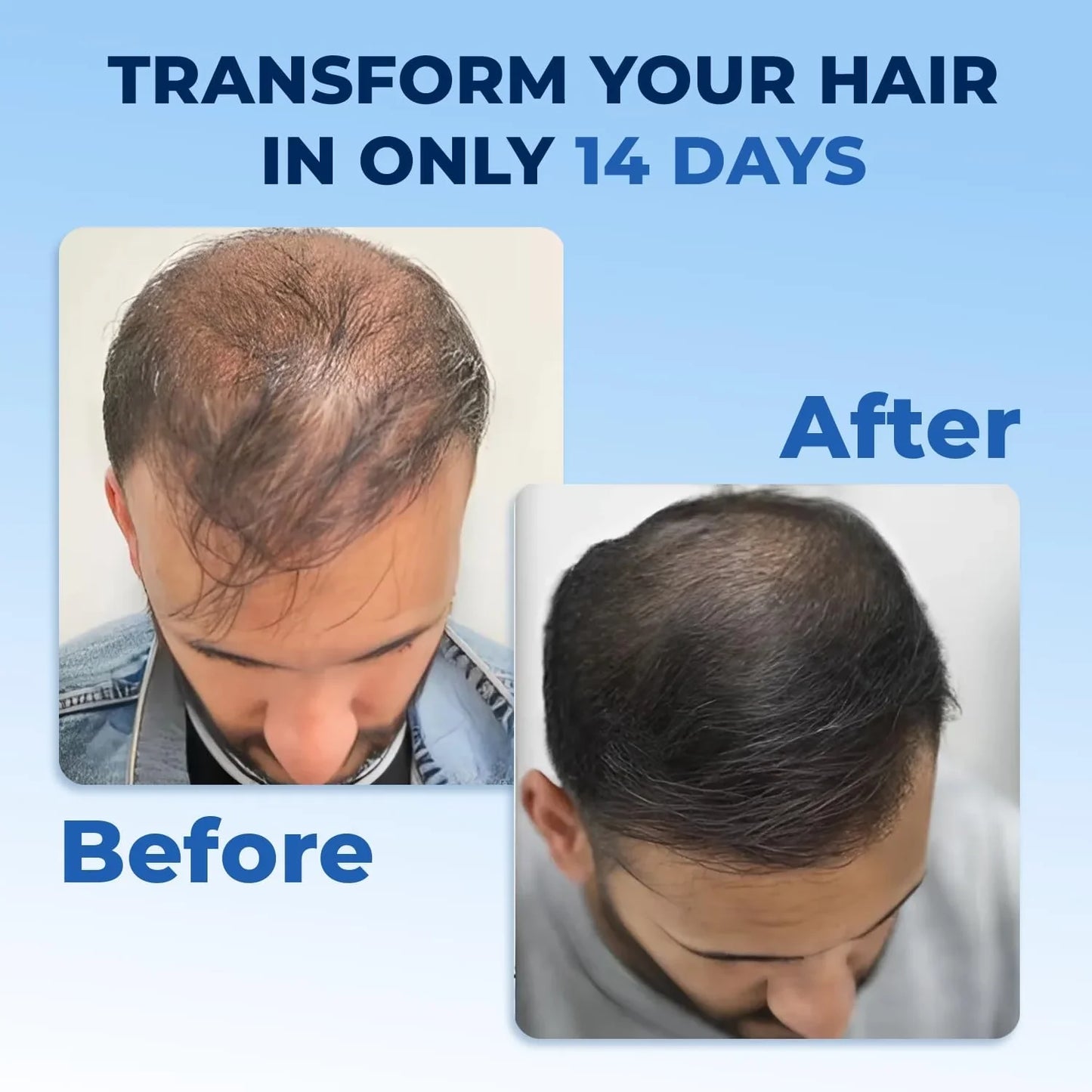 The Most Viral Hair Growth Spray – FEG Plus (USA-Imported Formula)