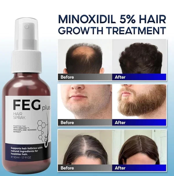 The Most Viral Hair Growth Spray – FEG Plus (USA-Imported Formula)