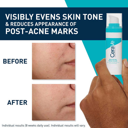 Cerave Resurfacing Retinol Serum – 30ml | Smooth & Radiant Skin