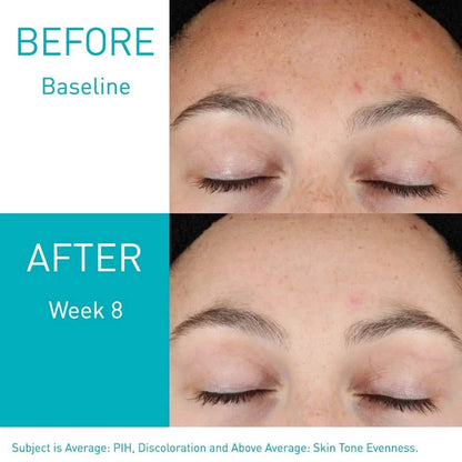 Cerave Resurfacing Retinol Serum – 30ml | Smooth & Radiant Skin