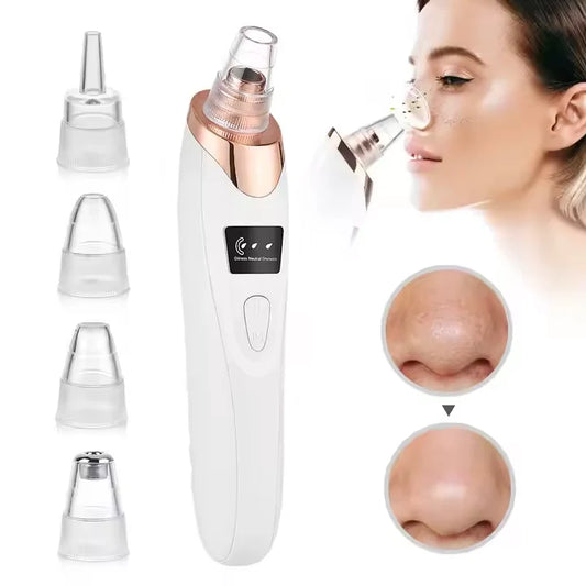 Electric Blackhead Remover Vacuum – Deep Pore Cleaner with LED & 4 Suction Heads for Face & Nose