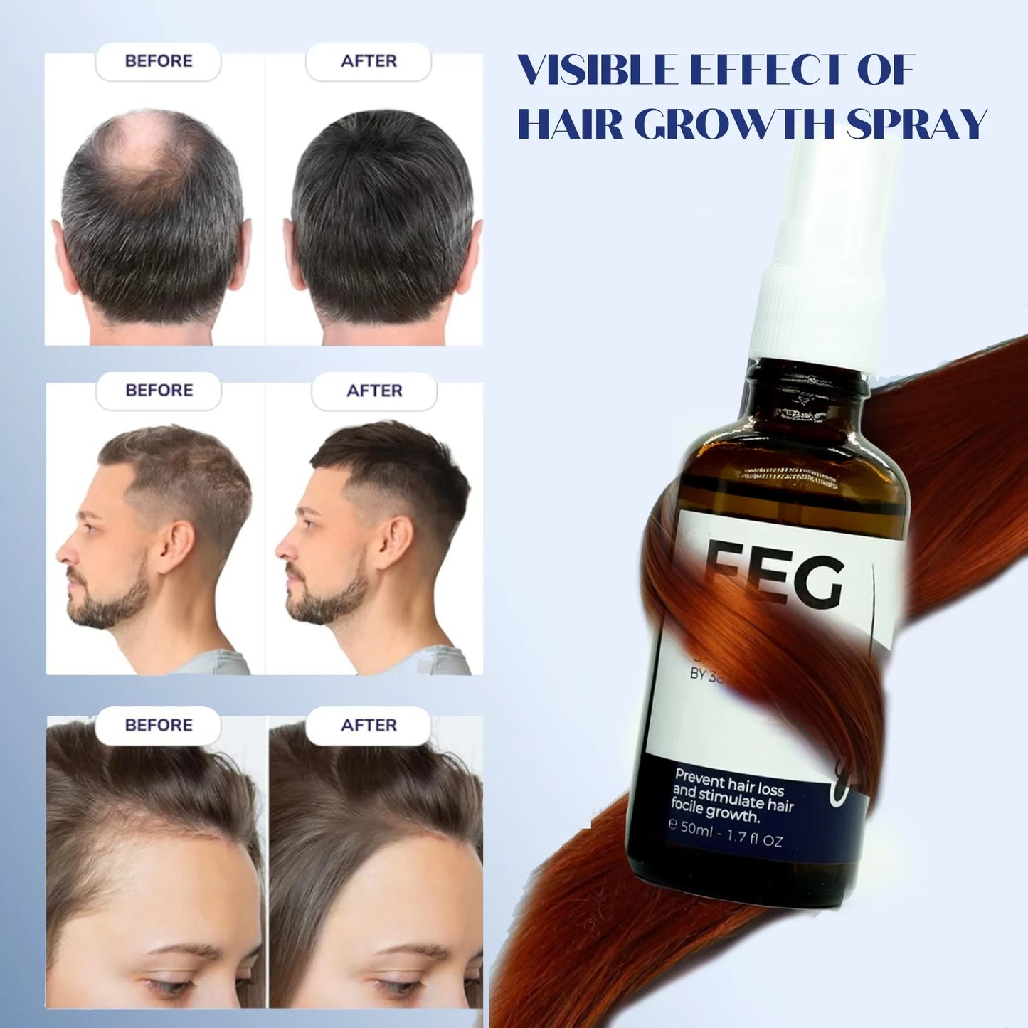The Most Viral Hair Growth Spray – FEG Plus (USA-Imported Formula)