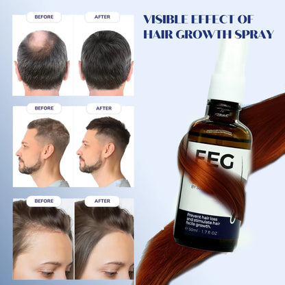 The Most Viral Hair Growth Spray – FEG Plus (USA-Imported Formula)