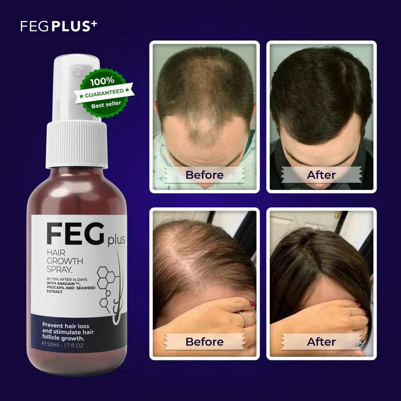 The Most Viral Hair Growth Spray – FEG Plus (USA-Imported Formula)