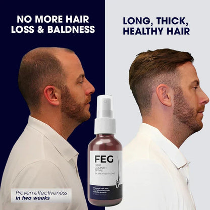 The Most Viral Hair Growth Spray – FEG Plus (USA-Imported Formula)